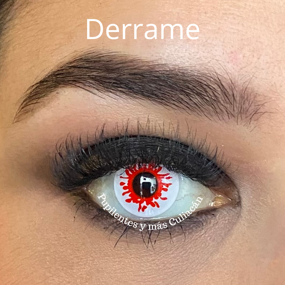 Derrame fantasía (pupila normal)